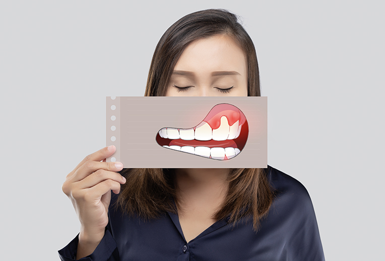 Periodoncia y cuidado de encias en Lugo